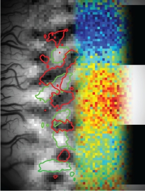 multiplexing